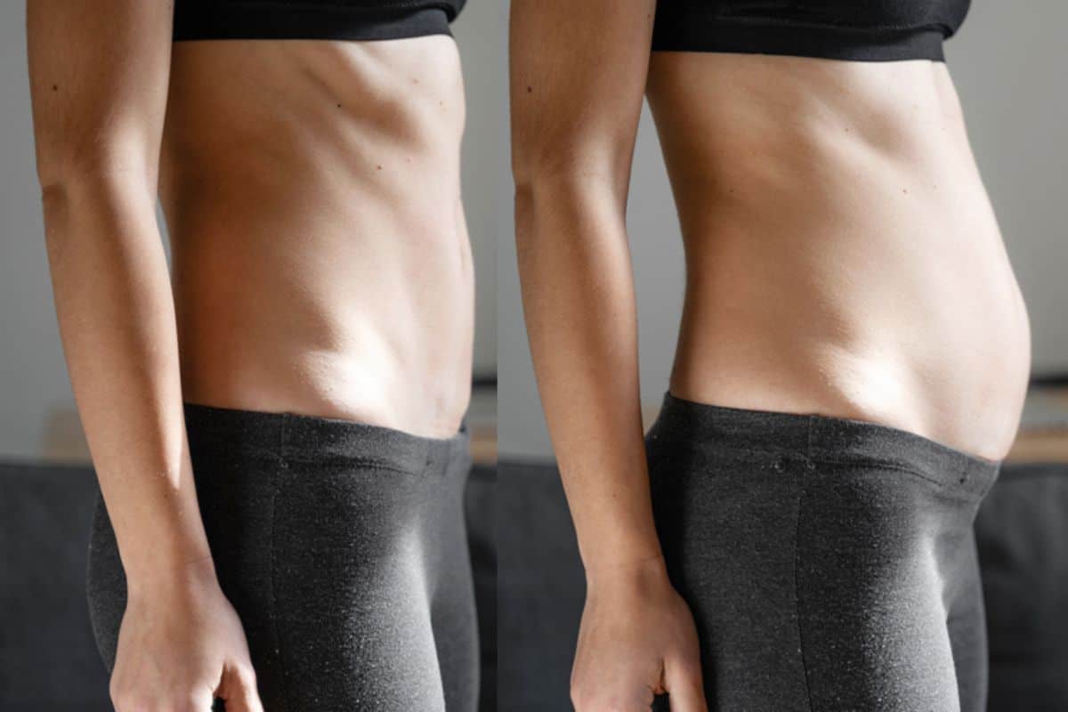 How long does diastasis recti take to improve Sandy?