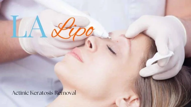 Woman receiving Actinic Keratosis Removal Treatment Sandy