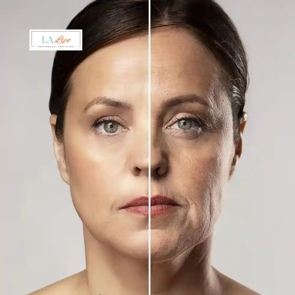 How Can You Tell If Non-Surgical Skin Tightening Is Right for You Sandy?