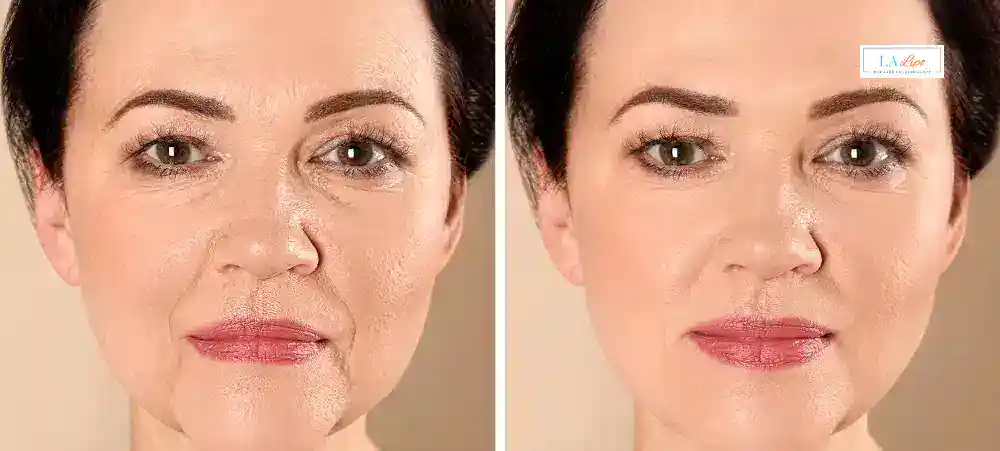 Why Aren’t My Skincare Products Making My Sagging Skin Look Firmer Sandy?
