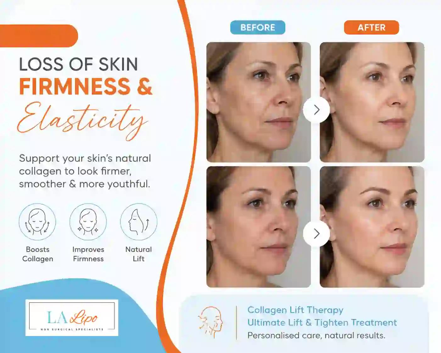 Sign #7: Loss of Skin Firmness and Elasticity Sandy